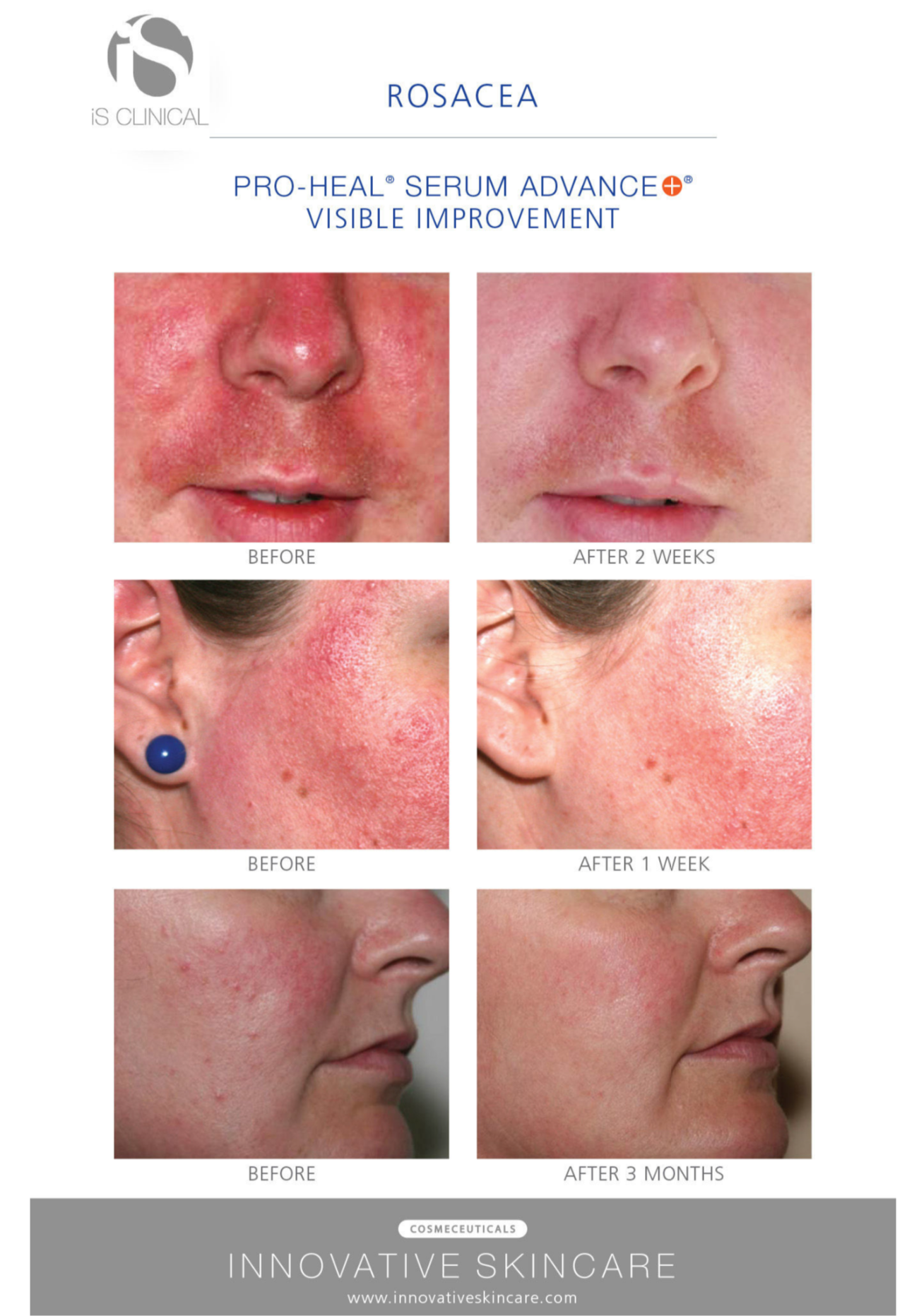 Pro Heal Serum 15 ml